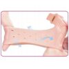 2-pack hallux valgus tåseparerare gel